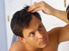 Causes de la chute des cheveux